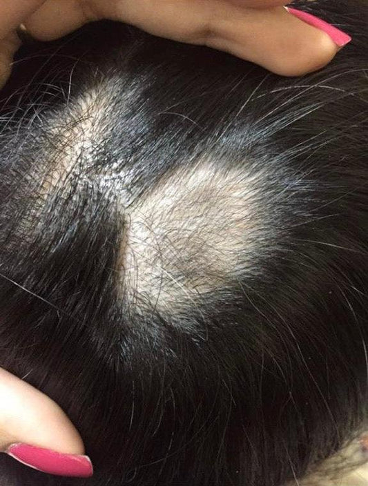 Kit Shampoo e Máscara Monovim - 1227